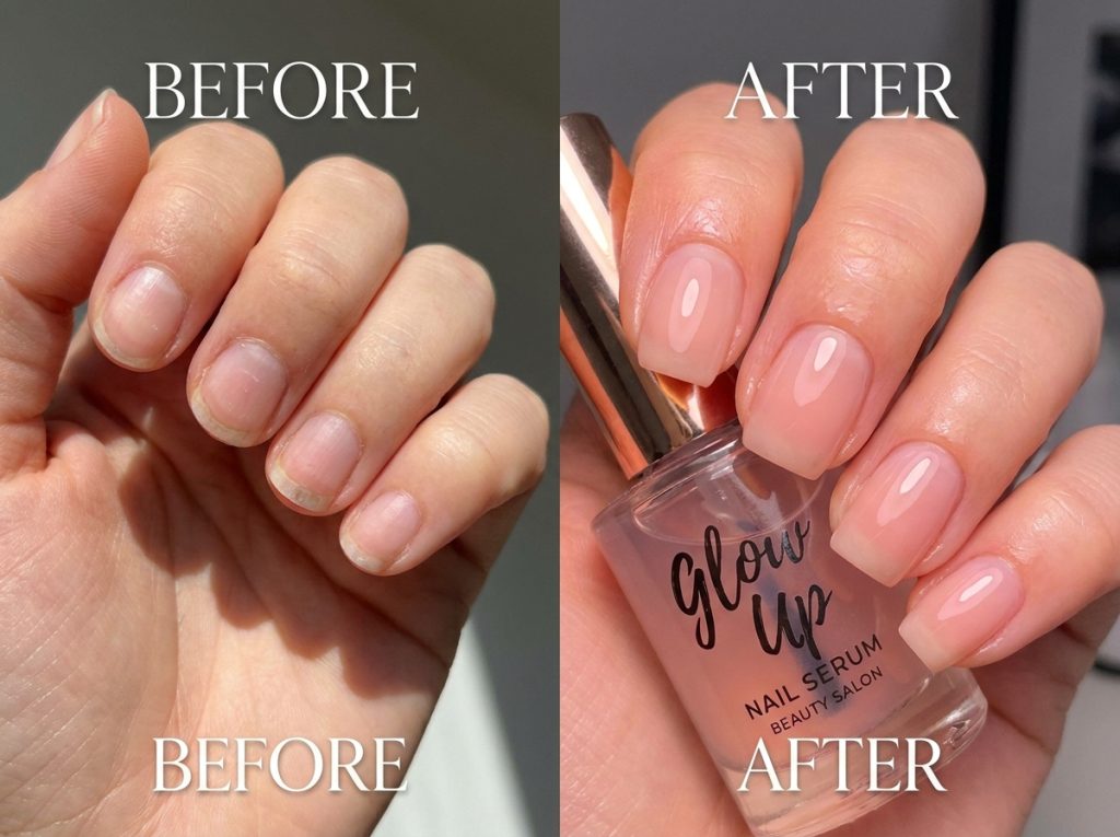 “before after nail glow up transformation, realistic nails, beauty concept”